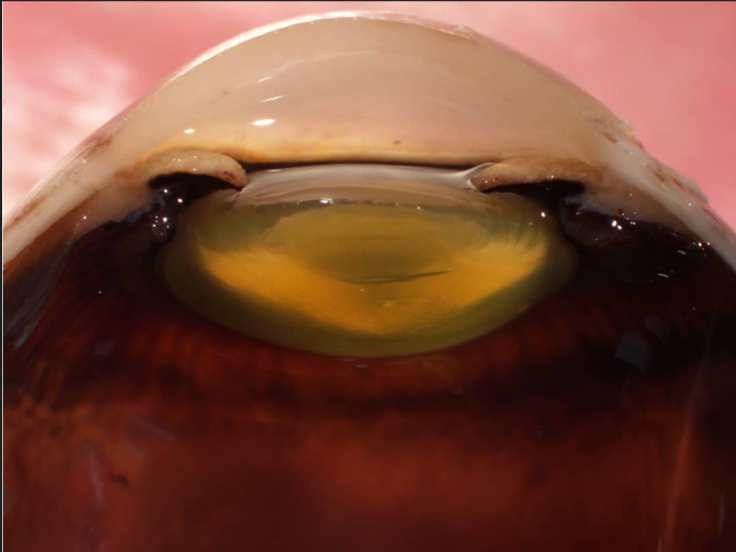 Human Eye Anatomy