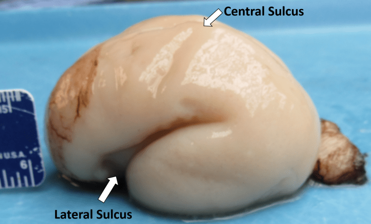 Fetal gyral development